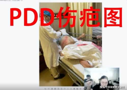 365账号为什么被限制使用.侧重点(图)